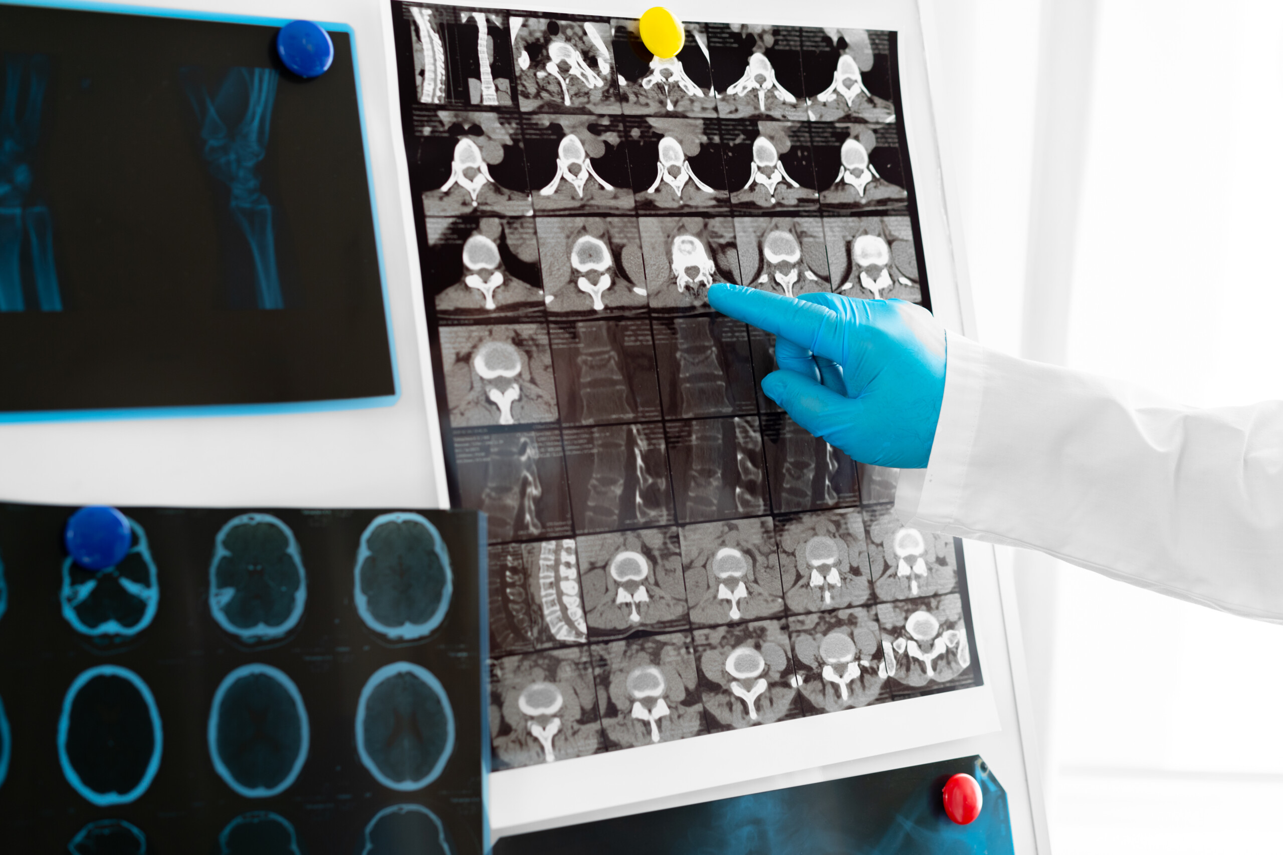 Hands of a doctor holding head mri scan